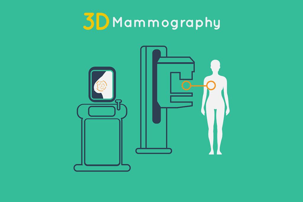 3D Mammography graphic